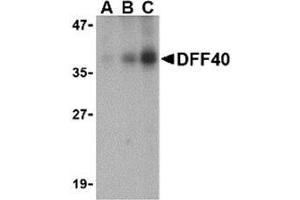 Western Blotting (WB) image for anti-DNA Fragmentation Factor, 40kDa, beta Polypeptide (Caspase-Activated DNase) (DFFB) (Intermediate Domain) antibody (ABIN499740)