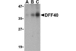 Western blot analysis of DFF40 in Jurkat cell lysate with AP30288PU-N DFF40 antibody at (A) 0. (DFFB Antikörper  (Intermediate Domain))