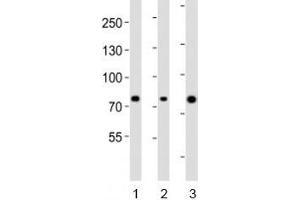 Western blot analysis of lysate from human 1) ovary, 2) placenta and 3) plasma lysate using Integrin beta 8 antibody diluted at 1:1000. (ITGB8 Antikörper  (AA 197-231))