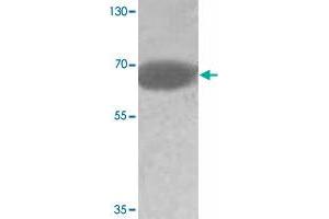 Western blot analysis of human fetal testis tissue lysate with ADAM20 polyclonal antibody  at 1:500 dilution. (ADAM20 Antikörper)