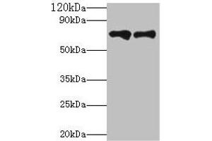 Western blot All lanes: Klkb1 antibody at 2 μg/mL Lane 1: Hela whole cell lysate Lane 2: Rat brain tissue Secondary Goat polyclonal to rabbit IgG at 1/10000 dilution Predicted band size: 72 kDa Observed band size: 72 kDa (KLKB1 Antikörper  (AA 391-638))