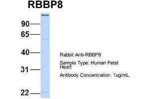 Host:  Rabbit  Target Name:  RBBP8  Sample Type:  Human Fetal Heart  Antibody Dilution:  1.
