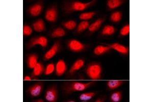 Immunofluorescence analysis of U2OS cells using ZEB1 Polyclonal Antibody (ZEB1 Antikörper)