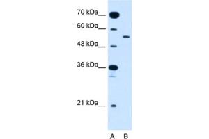 Western Blotting (WB) image for anti-Solute Carrier Family 2 (Facilitated Glucose Transporter), Member 10 (SLC2A10) antibody (ABIN2462768) (SLC2A10 Antikörper)