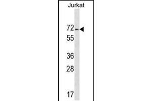 Western blot analysis in Jurkat cell line lysates (35ug/lane). (ZNF613 Antikörper  (C-Term))