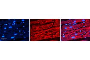 Rabbit Anti-CTBP1 Antibody   Formalin Fixed Paraffin Embedded Tissue: Human heart Tissue Observed Staining: Cytoplasmic Primary Antibody Concentration: N/A Other Working Concentrations: 1:600 Secondary Antibody: Donkey anti-Rabbit-Cy3 Secondary Antibody Concentration: 1:200 Magnification: 20X Exposure Time: 0.