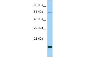 Host: Rabbit Target Name: CR1L Sample Type: ACHN Whole cell lysates Antibody Dilution: 1. (CR1L Antikörper  (N-Term))