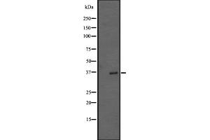 Western blot analysis of TRIB2 expression in A431 whole cell lysate ,The lane on the left is treated with the antigen-specific peptide. (TRIB2 Antikörper  (N-Term))