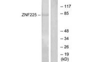 Western blot analysis of extracts from HeLa cells, using ZNF225 Antibody. (ZNF225 Antikörper  (AA 641-690))