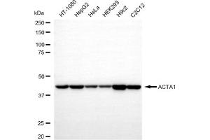 Western blotting analysis using ACTA1 antibody (ABIN7797457).