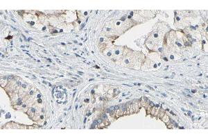 ABIN6277728 at 1/100 staining Human prostate tissue by IHC-P. (DVL1 Antikörper)