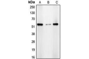 Western blot analysis of CDYL2 expression in A431 (A), HepG2 (B), HeLa (C) whole cell lysates. (CDYL2 Antikörper  (N-Term))