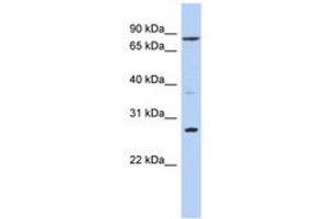 Image no. 1 for anti-Kruppel-Like Factor 12 (KLF12) (AA 51-100) antibody (ABIN6742325) (KLF12 Antikörper  (AA 51-100))