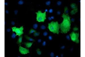 Anti-TMOD1 mouse monoclonal antibody (ABIN2454776) immunofluorescent staining of COS7 cells transiently transfected by pCMV6-ENTRY TMOD1 (RC201134). (Tropomodulin 1 Antikörper)