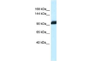 WB Suggested Anti-Zhx1 Antibody   Titration: 1.
