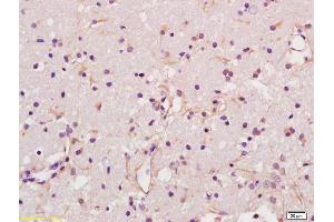 Formalin-fixed and paraffin embedded rat brain labeled with Anti-Glypican 6 Polyclonal Antibody, Unconjugated (ABIN678368) at 1:200 followed by conjugation to the secondary antibody and DAB staining (Glypican 6 Antikörper  (AA 351-450))