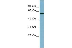WB Suggested Anti-CAP1  Antibody Titration: 0. (CAP1 Antikörper  (N-Term))