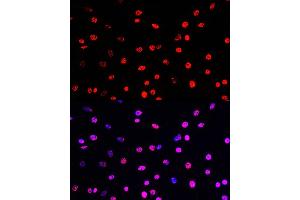 Immunofluorescence analysis of C6 cells using Phospho-Histone H3-T45 Rabbit pAb (ABIN7267692) at dilution of 100 (40x lens).