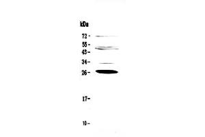 Western blot analysis of Factor D using anti-Factor D antibody .