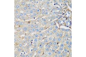 Immunohistochemistry of paraffin-embedded rat liver using PROCR antibody. (PROCR Antikörper  (AA 19-209))