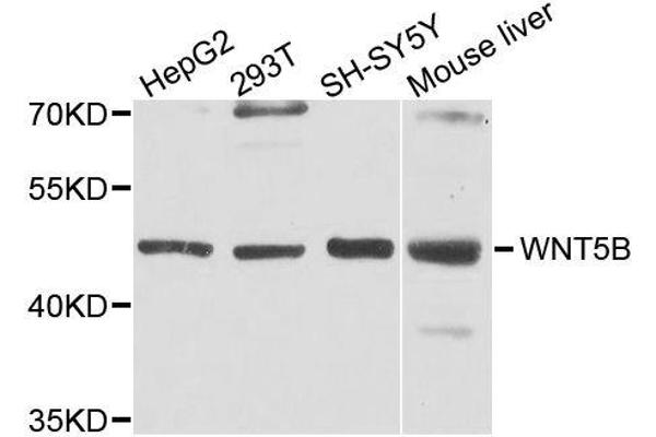 WNT5B Antikörper  (AA 120-359)