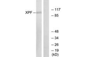 Western Blotting (WB) image for anti-Excision Repair Cross-Complementing Rodent Repair Deficiency, Complementation Group 4 (ERCC4) (AA 801-850) antibody (ABIN2889291) (ERCC4 Antikörper  (AA 801-850))