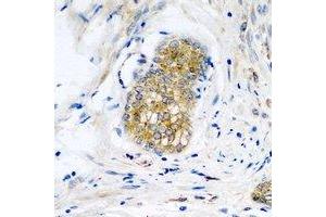 Immunohistochemical analysis of Neuroligin Y staining in human prostate formalin fixed paraffin embedded tissue section. (Neuroligin Y Antikörper)