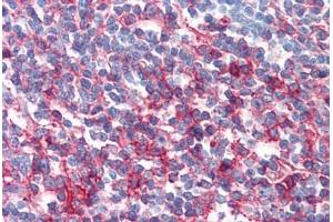 Human Tonsil (formalin-fixed, paraffin-embedded) stained with FAS antibody ABIN351542 at 10 ug/ml followed by biotinylated anti-mouse IgG secondary antibody ABIN481714, alkaline phosphatase-streptavidin and chromogen. (FAS Antikörper)
