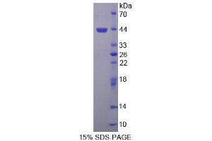 SDS-PAGE (SDS) image for Symplekin (SYMPK) (AA 1-347) protein (His tag) (ABIN4989608) (Symplekin Protein (SYMPK) (AA 1-347) (His tag))