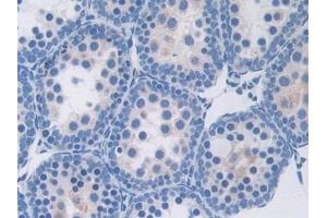 Immunohistochemistry (IHC) image for anti-Thrombospondin 1 (THBS1) (AA 515-671) antibody (ABIN7438112)