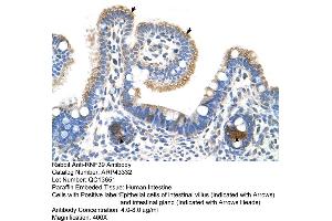 Human Intestine (RNF39 Antikörper  (N-Term))