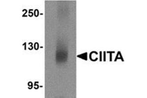 Western blot analysis of CIITA in mouse brain tissue lysate with CIITA antibody at 1 μg/ml. (CIITA Antikörper  (N-Term))