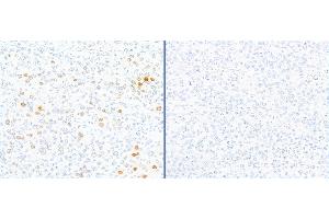 Immunohistochemistry (IHC) image for anti-gamma Histone Variant H2AX (GAMMA-H2AX) (Ser140) antibody (ABIN7449557) (gamma H2AX Antikörper  (Ser140))