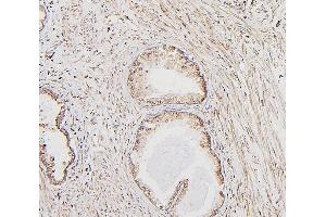 IHC analysis of CALR using anti-CALR antibody (ABIN7600329).