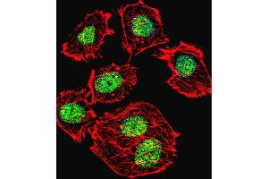 Fluorescent confocal image of  cell stained with p53 Antibody  h. (p53 Antikörper  (AA 293-322))