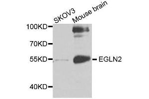 Western blot analysis of extracts of various cell lines, using EGLN2 antibody. (PHD1 Antikörper  (AA 150-250))