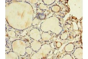 Immunohistochemistry of paraffin-embedded human thyroid tissue using ABIN7175757 at dilution of 1:100 (WDR49 Antikörper  (AA 251-500))