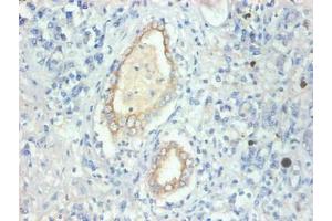 Immunohistochemical of paraffin-embedded human kidney tissue using ABIN7152614 at dilution of 1:200 (FABP3 Antikörper)