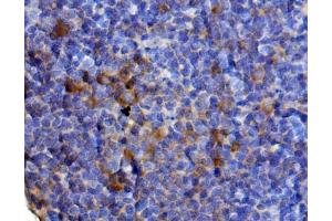 IHC analysis of Il13 using anti-Il13 antibody (ABIN7600672). (IL-13 Antikörper  (AA 22-131))