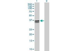 Western Blot analysis of ST3GAL2 expression in transfected 293T cell line by ST3GAL2 MaxPab polyclonal antibody. (ST3GAL2 Antikörper  (AA 1-350))