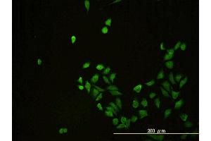 Immunofluorescence of monoclonal antibody to CD58 on HeLa cell. (CD58 Antikörper  (AA 1-240))