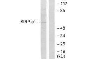 Western blot analysis of extracts from HepG2 cells, using Sirp alpha1 Antibody. (SIRPA Antikörper  (AA 451-500))