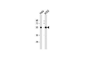 All lanes : Anti-IRAK4 Antibody (N-term) at 1:1000 dilution Lane 1: Hela whole cell lysate Lane 2: K562 whole cell lysate Lysates/proteins at 20 μg per lane.