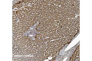 IHC analysis of ALK-1/ACVRL1 using anti-ALK-1/ACVRL1 antibody (ABIN7601037).