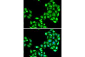 Immunofluorescence analysis of A549 cell using OGFR antibody. (OGFR Antikörper)