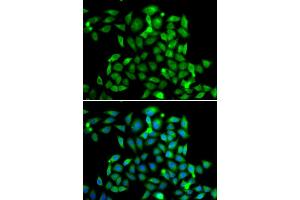 Immunofluorescence analysis of A549 cell using CLASP1 antibody.