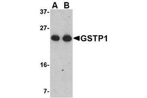 Western blot analysis of GSTP1 in Jurkat cell lysate with AP30389PU-N GSTP1 antibody at (A) 0. (GSTP1 Antikörper  (Center))