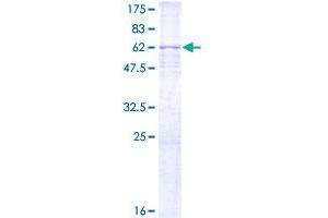 Image no. 1 for Cyclin-Dependent Kinase 7 (CDK7) (AA 1-346) protein (GST tag) (ABIN1348979) (CDK7 Protein (AA 1-346) (GST tag))