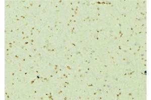 Immunohistochemistry (IHC) image for anti-Proteasome (Prosome, Macropain) 26S Subunit, ATPase, 5 (PSMC5) (Internal Region) antibody (ABIN6264482)