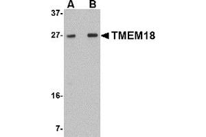 Western Blotting (WB) image for anti-Transmembrane Protein 18 (TMM18) (C-Term) antibody (ABIN1030748) (Transmembrane Protein 18 (TMM18) (C-Term) Antikörper)